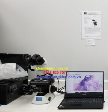 Khang kiên cung cấp camera cho kính hiển vi tốt nhất hiện nay