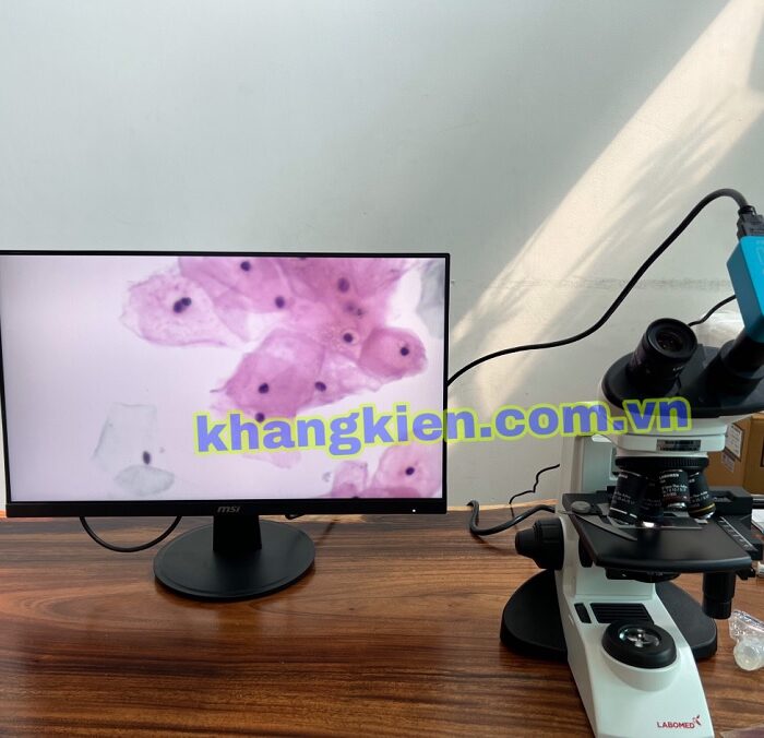 Chất lượng kính hiển vi CXL rất tốt
